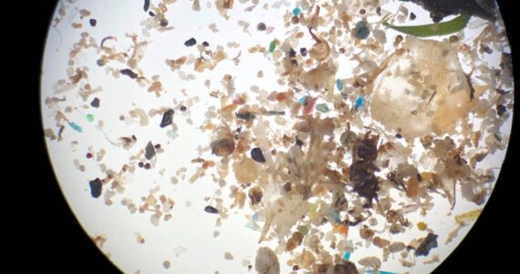 Micro-photograph of microplastics collected from Hudson River water.
Photo credit Hudson River Park