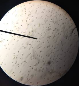 Contributed photo
What a heterosigma bloom looks like under the microscope.